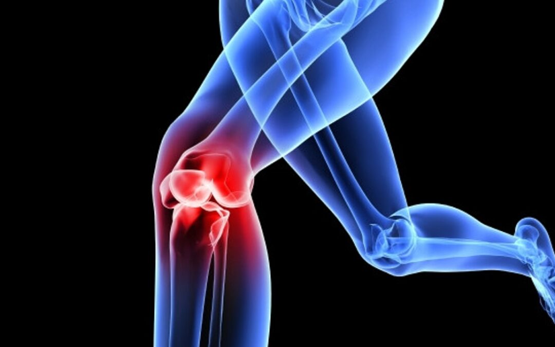 Knee Injuries and Alignment