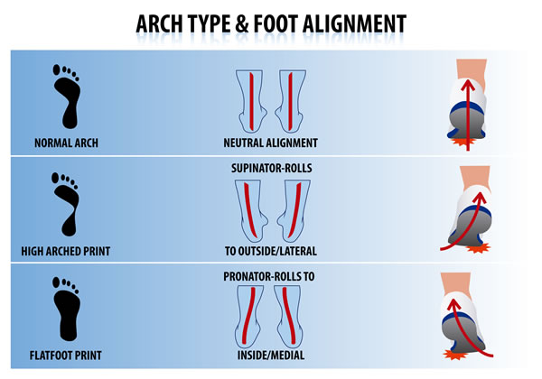 The Pain Free Athlete :: Foot Alignment