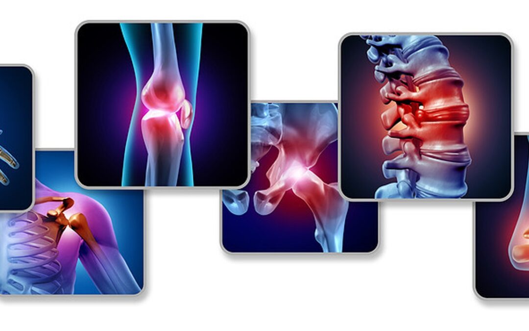 Osteoarthritis: The Latest Research