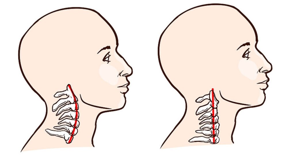 neck-pain-and-posture-jessica-kisiel-wellness-blog